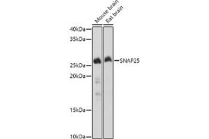 Western blot analysis of extracts of various cell lines, using SN antibody (ABIN3021231, ABIN3021232, ABIN3021233 and ABIN6214078) at 1:1000 dilution. (SNAP25 anticorps  (AA 1-206))