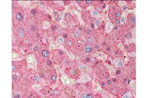 Immunohistochemistry of Goat Anti-Fibrinogen antibody.