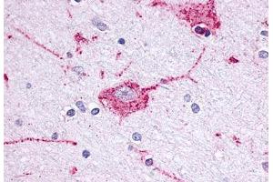 Anti-OPRM1 / Mu Opioid Receptor antibody  ABIN1049170 IHC staining of human brain, neuron. (Mu Opioid Receptor 1 anticorps  (Extracellular Domain))