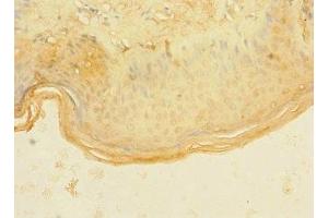 Immunohistochemistry of paraffin-embedded human skin tissue using ABIN7144737 at dilution of 1:100 (ASPHD1 anticorps  (AA 96-390))