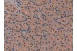 Detection of CD2AP in Rat Stomach Tissue using Polyclonal Antibody to CD2 Associated Protein (CD2AP) (CD2AP anticorps  (AA 368-623))