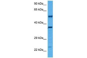 Host:  Rabbit  Target Name:  SMAD1  Sample Tissue:  Mouse Kidney  Antibody Dilution:  1ug/ml (SMAD1 anticorps  (Middle Region))