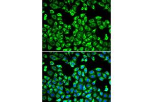 Immunofluorescence analysis of MCF-7 cell using PSMC2 antibody. (PSMC2 anticorps  (AA 1-160))