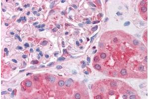 Human Kidney: Formalin-Fixed, Paraffin-Embedded (FFPE)