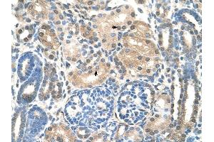 UBE2E2 antibody was used for immunohistochemistry at a concentration of 4-8 ug/ml to stain EpitheliaI cells of renal tubule (arrows) in Human Kidney. (UBE2E2 anticorps)