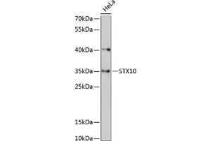 Western blot analysis of extracts of HeLa cells, using STX10 antibody (ABIN6129720, ABIN6148651, ABIN6148652 and ABIN6217958) at 1:3000 dilution. (Syntaxin 10 anticorps  (AA 76-165))