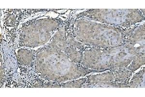 IHC analysis of Carbonic Anhydrase I/CA1 using anti-Carbonic Anhydrase I/CA1 antibody (ABIN7602621). (CA1 anticorps  (AA 9-261))