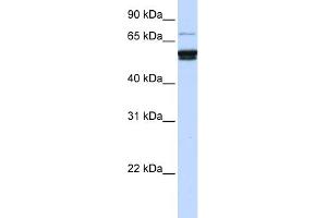 WB Suggested Anti-ZNF93 Antibody Titration:  0. (ZNF93 anticorps  (N-Term))