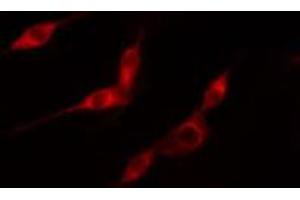 ABIN6274148 staining HeLa cells by IF/ICC.