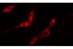 ABIN6274148 staining HeLa cells by IF/ICC. (TK1 anticorps  (N-Term))