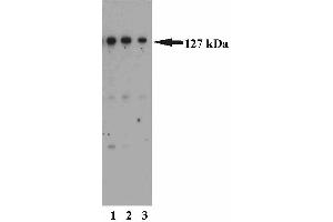Western blot analysis of MSH3 on a HeLa cell lysate (Human cervical epitheloid carcinoma, ATCC CCL-2). (MSH3 anticorps  (AA 136-349))