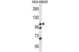 Western Blotting (WB) image for anti-Catenin (Cadherin-Associated Protein), delta 2 (Neural Plakophilin-Related Arm-Repeat Protein (CTNND2) antibody (ABIN2996812) (CTNND2 anticorps)