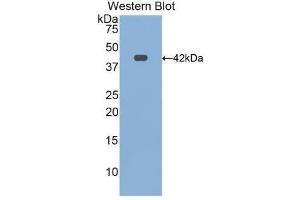 Western Blotting (WB) image for anti-Transferrin Receptor 2 (TFR2) (AA 4-87) antibody (ABIN1172689) (Transferrin Receptor 2 anticorps  (AA 4-87))