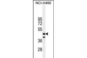 FGL2 Antibody (C-term) (ABIN655073 and ABIN2844705) western blot analysis in NCI- cell line lysates (35 μg/lane). (FGL2 anticorps  (C-Term))