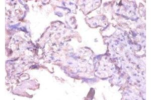 Immunohistochemistry of paraffin-embedded human placenta tissue using ABIN7156957 at dilution of 1:100 (MMP1 anticorps  (AA 101-469))