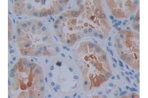 Detection of CRYaB in Human Kidney Tissue using Polyclonal Antibody to Crystallin Alpha B (CRYaB)
