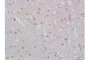 Formalin-fixed and paraffin embedded rat brain tissue labeled with Rabbit Anti-EpCAM/CD326 Polyclonal Antibody , Unconjugated at 1:200 followed by conjugation to the secondary antibody and DAB staining. (EpCAM anticorps  (AA 53-150))