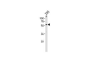 anti-Zinc Finger Protein 76 (Expressed in Testis) (ZNF76) (AA 388-415), (C-Term) antibody