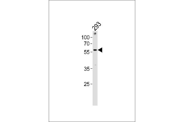 ZNF76 anticorps  (C-Term)