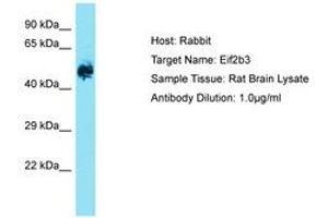 Image no. 1 for anti-Eukaryotic Translation Initiation Factor 2B, Subunit 3 Gamma, 58kDa (EIF2B3) (AA 121-170) antibody (ABIN6750525) (EIF2B3 anticorps  (AA 121-170))
