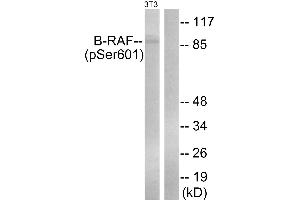 Immunohistochemistry analysis of paraffin-embedded human placenta tissue using B-Raf (Phospho-Ser602) antibody.