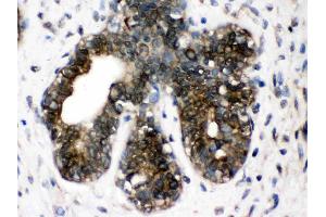 IHC analysis of TCP1 delta using anti- TCP1 delta antibody .