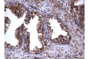 Image no. 9 for anti-Tumor Necrosis Factor Receptor Superfamily, Member 8 (TNFRSF8) (AA 19-379) antibody (ABIN1491084)