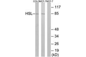 Western Blotting (WB) image for anti-Lipase, Hormone-Sensitive (LIPE) (AA 518-567) antibody (ABIN2888636) (LIPE anticorps  (AA 518-567))