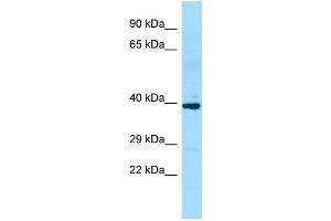 WB Suggested Anti-SLC35D2 Antibody Titration: 1. (Solute Carrier Family 35 (UDP-GlcNAc/UDP-Glucose Transporter), Member D2 (SLC35D2) (C-Term) anticorps)
