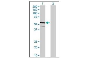 Western Blotting (WB) image for anti-Interferon Regulatory Factor 4 (IRF4) (AA 342-452) antibody (ABIN614626)