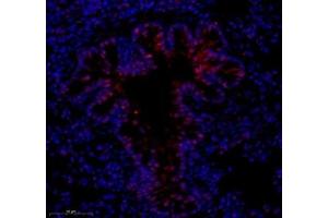 Immunofluorescence of paraffin embedded rat lung using notch3 (ABIN7074862) at dilution of 1:650 (350x lens)