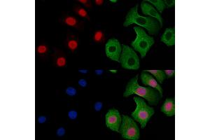 ABIN6257869 and ABIN6273599 staining Hela cells by IF/ICC. (ESRP2 anticorps  (N-Term))