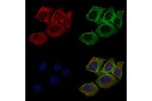 ABIN6265513 and ABIN6276479 staining HepG2 cells by IF/ICC. (TDGF1 anticorps  (Internal Region))