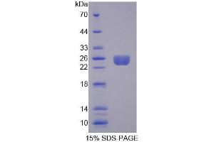 SDS-PAGE (SDS) image for rho Guanine Nucleotide Exchange Factor (GEF) 7 (ARHGEF7) (AA 1-188) protein (His tag) (ABIN4990859)