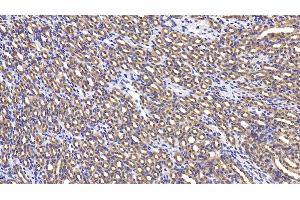 Detection of LY96 in Mouse Kidney Tissue using Polyclonal Antibody to Lymphocyte Antigen 96 (LY96) (LY96 anticorps  (AA 16-160))