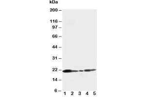 Western blot testing of Caveolin-1 antibody and Lane 1:  U87 (Caveolin-1 anticorps  (C-Term))