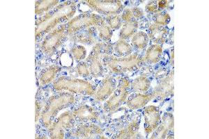 Immunohistochemistry of paraffin-embedded rat kidney using PDCD6 antibody at dilution of 1:200 (40x lens).