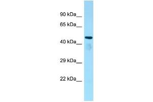 WB Suggested Anti-Atat1 Antibody Titration: 1. (Chromosome 6 Open Reading Frame 134 (C6orf134) (Middle Region) anticorps)