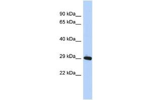 WB Suggested Anti-ZNF524 Antibody Titration:  0. (ZNF524 anticorps  (N-Term))