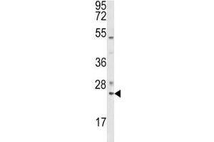 Western blot analysis of RAB7 antibody and K562 lysate. (RAB7A anticorps  (AA 176-204))
