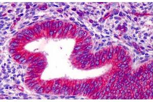 Human Uterus: Formalin-Fixed, Paraffin-Embedded (FFPE) (HMGCS1 anticorps  (AA 251-300))