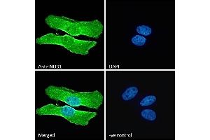 (ABIN184662) Immunofluorescence analysis of paraformaldehyde fixed HeLa cells, permeabilized with 0.
