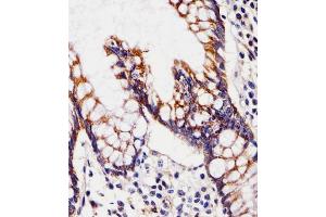 (ABIN6243813 and ABIN6577796) staining CHST12 in Human small intestine tissue sections by Immunohistochemistry (IHC-P - paraformaldehyde-fixed, paraffin-embedded sections). (CHST12 anticorps  (N-Term))