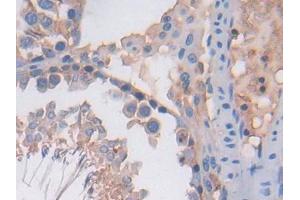 IHC-P analysis of Rat Testis Tissue, with DAB staining. (PF4 anticorps  (AA 30-105))