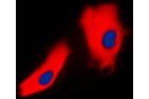 Immunofluorescent analysis of Gamma-catenin staining in A431 cells. (JUP anticorps  (C-Term))