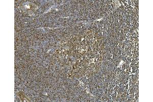 IHC analysis of Hsc70 using anti-Hsc70 antibody (ABIN7601962). (Hsc70 anticorps  (AA 520-614))