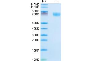 Mouse Complement Factor D on Tris-Bis PAGE under reduced condition.
