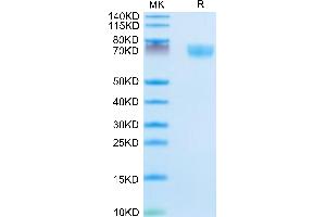 Mouse Complement Factor D on Tris-Bis PAGE under reduced condition. (Adipsin Protein (AA 26-259) (Fc Tag))
