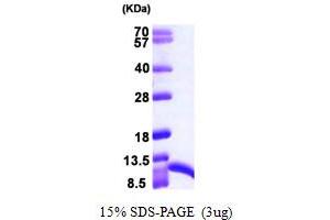 SDS-PAGE (SDS) image for S100 Calcium Binding Protein A6 (S100A6) (AA 1-90) protein (His tag) (ABIN667387)