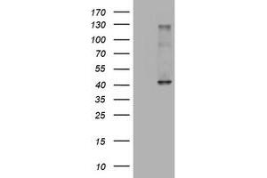 Western Blotting (WB) image for anti-alpha-1,4-N-Acetylglucosaminyltransferase (A4GNT) (AA 121-340) antibody (ABIN2715588) (A4GNT anticorps  (AA 121-340))